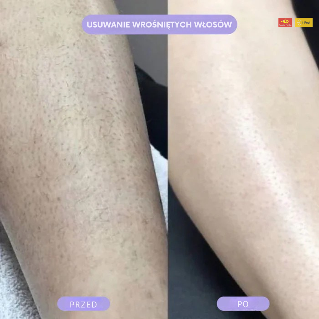 Podwójna precyzyjna maszynka do golenia wszędzie